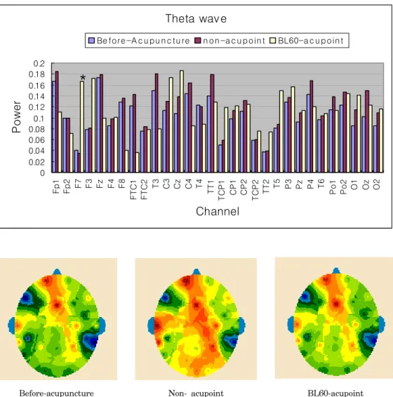 Fig.  4.  Distribution  of  theta  wave  of  the  EEG  from  30  channels  before  and  during  the  EA  treatment.