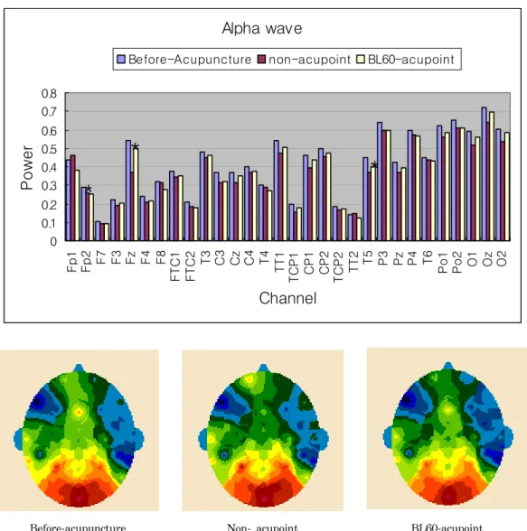 Fig.  2.  Distribution  of  alpha  wave  of  the  EEG  from  30  channels  before  and  during  the  EA  treatment.