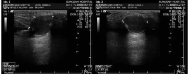 Figure  2.  THYROID  USG  2007-12-07