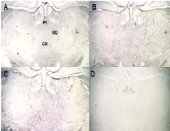 Fig.  3  c-Fos  expression  in  the  thalamus (A)  Normal  :  Non  -  treated  group