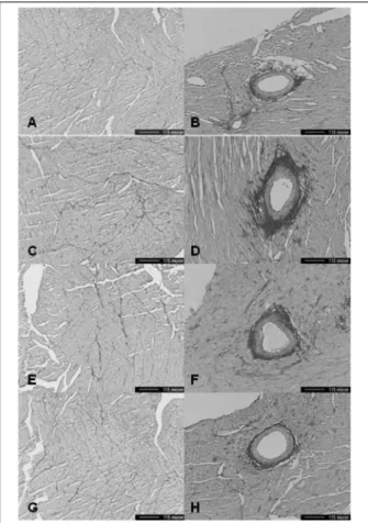 Fig. 1. Light micrographs of the myocardium (×100, picrosirius red stain) reveal that the fibrosis of perivascular area and  inter-stitial area is increased in SHR compared to WKY