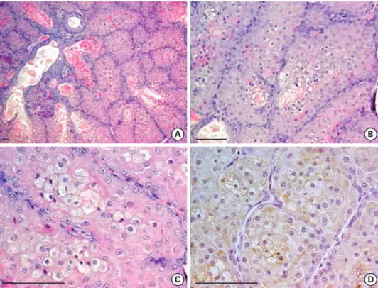 Fig. 2. Microscopic examination of the mass in a male wild nutria. (A) The mass is composed of reserved basal  cells and secretory cells containing oily and waxy matter, which constitute a type of sebaceous gland