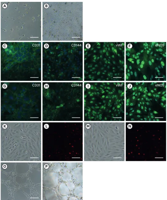Fig. 5. Characterization of the derived piPS-ECs. (A) Typical microscope images of piPSC-ECs 1 day after flow  cytometric sorting; scale bar = 80 μm