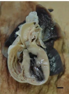 Fig. 3. Necropsy imaging. The left ventricular outflow tract was opened, and the sinus of Valsalva was found to  have a diameter of 7 mm (bar = 5 mm).
