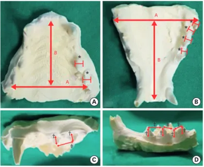 Fig. 1. The parameters measured using digital calipers. (A) maxilla A, B and width of maxillary PM3 and PM4 ( * )