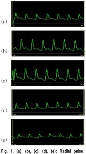 Fig.  1.  (a),  (b),  (c),  (d),  (e):  Radial  pulse  wave  forms  when  50g,  90g,  140g,  190g,  240g  pressure  was  applied  respectively 