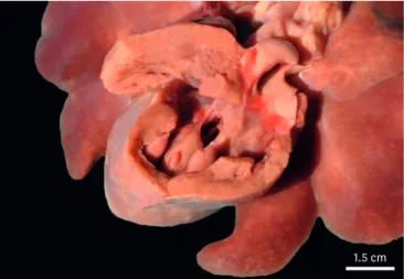 Fig. 3. Gross examination of the heart. Globular-looking heart with a pale color, showing interventricular septal  defect, 2 cm in diameter, which connected the right and left ventricles.