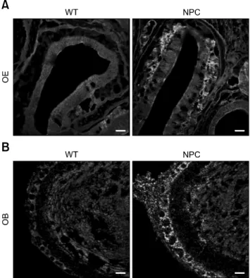 Fig. 2. Distribution patterns of olfactory sensory neurons and  other periglomerular neurons in the olfactory epithelium (OE; A) and olfactory bulb (OB; B) revealed by immunohistochemical  analysis