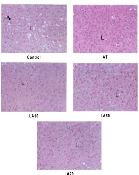 Fig. 10. Light micrographs of liver from acupuncture group and acupuncture combined LLLT groups on  the hepatic tissue in hyperlipemia rats