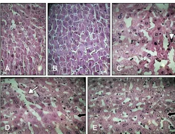 Fig. 4. Photomicrographs of liver sections of the experimental  groups. (A) Normal histological appearance of liver tissue of a  control mouse