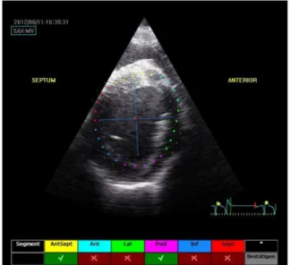 Fig. 1. Right parasternal short axis beneath the mitral valve: 