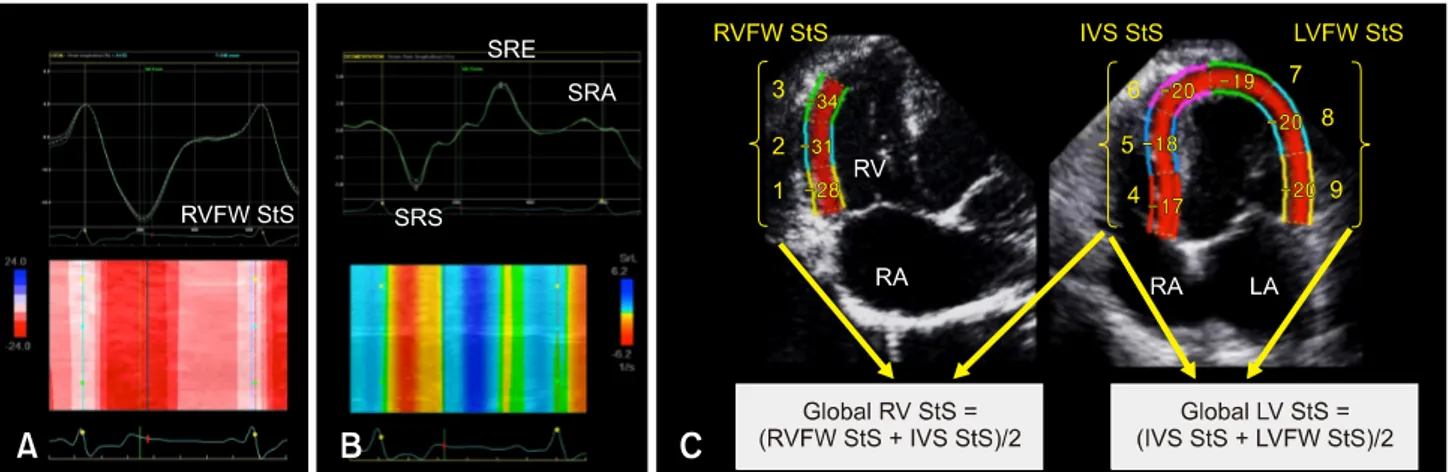 Fig. 1. Representative speckle-tracking imaging examination performed for this study. (A) Representative longitudinal right ventricular (RV) strain profiles obtained from 3 segments (i.e., basal, middle, and apical) of the RV free wall (RVFW)