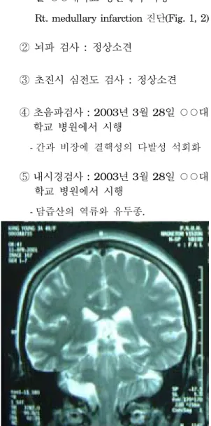 Fig  1.  MRI  of  Brain,  coronary  view