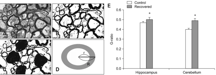 Fig. 5. A stepwise image conversion process to calculate the G-ratio. (A) An original image was converted to a black and white image  by applying a threshold that would only reveal myelin sheaths