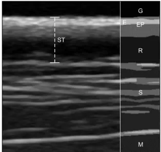 Fig. 1. Ultrasonographic appearance of normal skin in dogs. The echogenic layer is a papillary dermis with epidermis (EP)