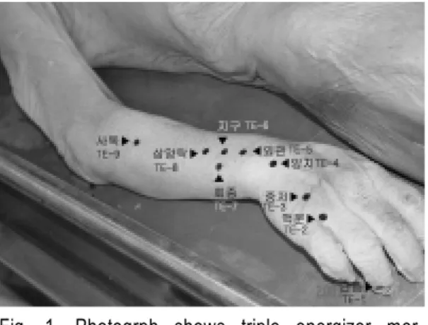 Fig. 2. Photograph shows triple energizer mer- mer-idianpoints(TE 1-TE 8) at deep fascia of  forearm.(△ : Extensor digitorum m.)