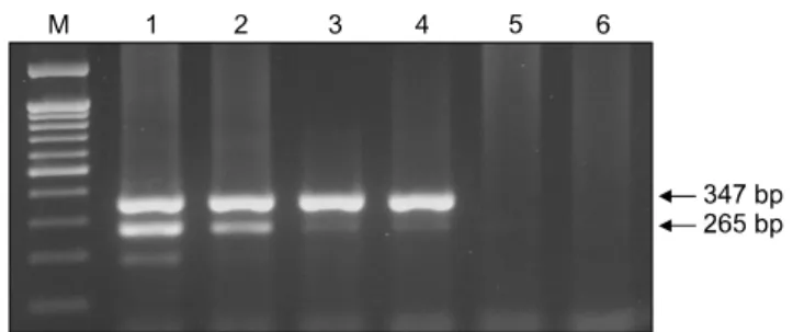 Fig. 1. Cross-reactivity of the duplex nested reverse transcriptase polymerase chain reaction method
