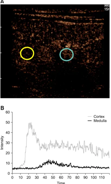 Fig. 2. Two regions of interest were placed over the renal cortex  (yellow circle) and medulla (blue circle) (A), and time-intensity  curves were created (B)