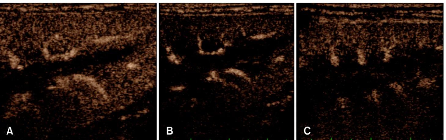 Fig. 3. Contrast-enhanced ultrasonography images obtained at the time of peak intensity in the renal cortex at baseline (A), day 4 (B), and day 10 (C)