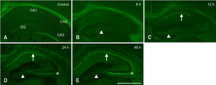 Table 2. The time-course level of hippocalcin immunoreactivity  in cells of the mouse hippocampus following pilocarpine-induced  SE