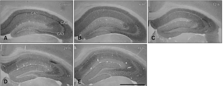 Fig. 3. Immunohistochemistry for hippocalcin in the CA1 region of the control- (A) and pilocarpine-treated (B–E) groups
