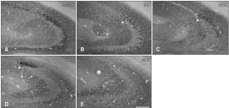 Fig. 4. Immunohistochemistry for hippocalcin in the CA2/3 region of the control- (A) and pilocarpine-treated (B–E) groups