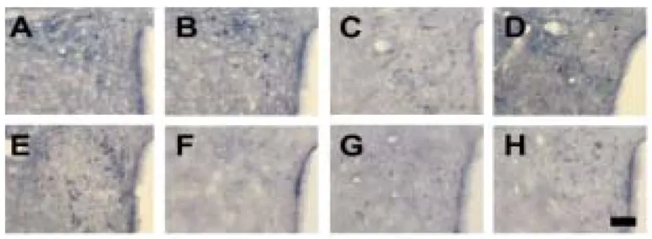 Fig. 2. Distribution of NADPH-diaphorase positive neurons in hypothalamic regions  Scale  bar  represents  80  µm.