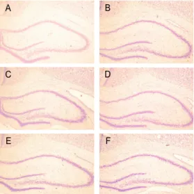 Fig.  6  Representive  microphotographs  of  coronal  sections  in  the  hippocampal  CA1
