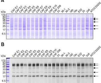 Fig. 2. Electrophoresis (SDS-PAGE) (A) and Western blot (B)  analysis of whole cell lysates from E