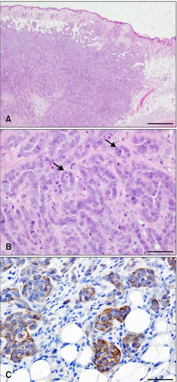 Fig. 2. SNP mammary gland tumor from subcutaneous tumor  tissue, NOD.CB17-Prkdc scid /J mice