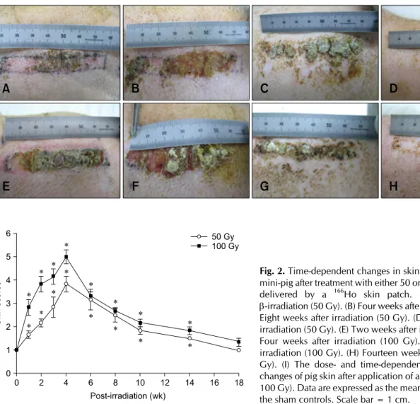 Fig. 2. Time-dependent changes in skin gross morphology of a  mini-pig after treatment with either 50 or 100 Gy of -irradiation  delivered by a  166 Ho skin patch