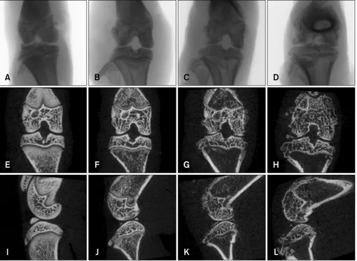 Fig. 1. X-ray projection image along with coronal and sagittal images of the hind knee joint of collagen-treated rats generated by  micro-CT