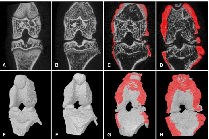 Fig. 3. Visualization of osteophytes in micro-CT coronal (A~D) and 3D images (E~H) of the hind knee joint of collagen-treated rats at weeks 0, 2, 3, and 4