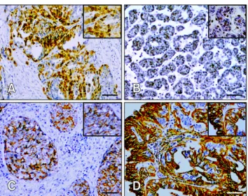 Table 2. COX-2, CD44, Oct-3/4, and EGFR expression correlated with different histological types*