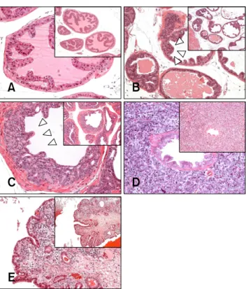 Fig. 2. Cytokeratin 8 expression in pathologic grades of TRAMP.