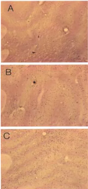 Fig 7. Expression of c-Fos in the nucleus accum- accum-bens after systemic injections of nicotine in  saline or nicotine pretreated rats
