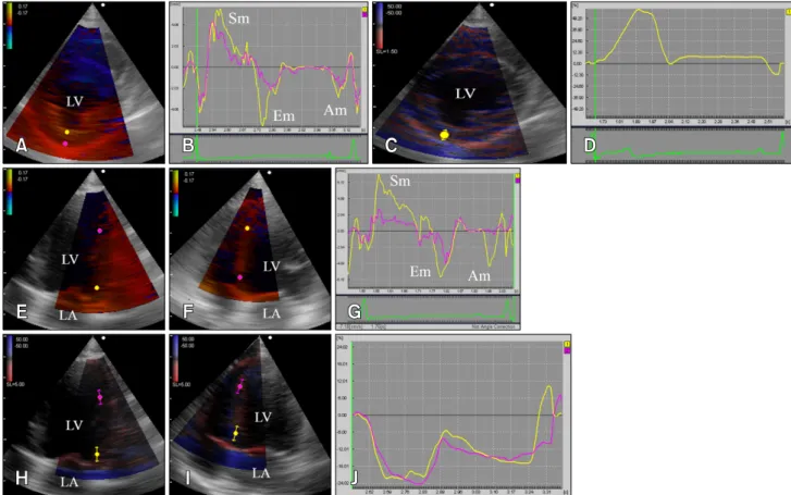 Fig. 1. Examples of radial velocity and strain (A–D) assessment on right parasternal short-axis view at the level of papillary muscles and longitudinal velocity and strain assessment (E–H) of left ventricle (LV) on left apical four chamber view in a health