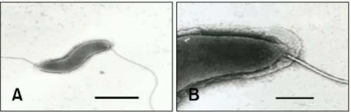 Fig. 1. Transmission electron micrograph of a negatively stained Helicobacter sp. Nov