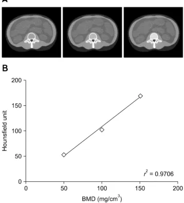 Fig. 2. The method of conversion of the Hounsfield units (HU)  value to bone mineral density (BMD)