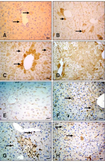 Fig. 3. PCNA, TNFα, and FGF-2 immunohistochemistry in  hepatocytes from the experimental and control groups