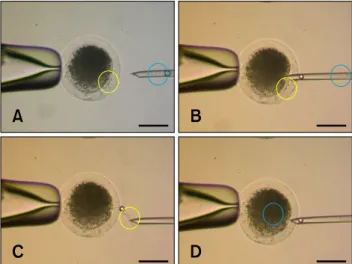 Fig. 1. Schematic diagram illustrating the SONT (B) and CTNT  (A) protocols. The black arrowheads indicate the protruding  chromosomes (oval) and first polar body (round)