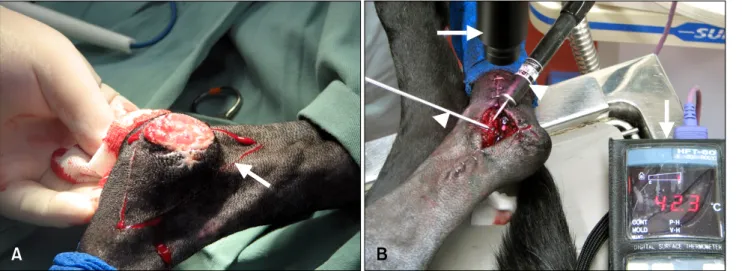 Fig. 1. (A) Skin incision (arrow) in case C07. (B) PHCT was performed after surgery. The arrow indicates the broadband light source while the arrowheads indicate the thermometer and thermometer sensor