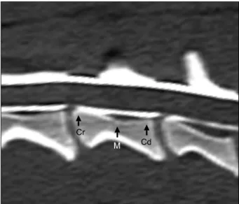 Fig. 1. Reformatted sagittal image of the fourth cervical vertebra derived from the initial transverse image