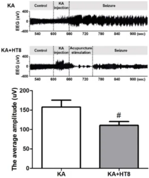 Fig. 5. Electroencephalography recording after kainic acid(KA). Acupuncture stimulation at HT8 suppressed the KA-induced increase of the  am-plitude.