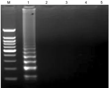 Fig. 1. Comparing the sensitivity of RT-LAMP and RT-PCR for  the detection of C-type FMDV using agarose gel electrophoresis