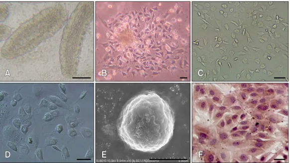 Fig. 1. Morphology of intestinal cells in culture. Phase contrast microscopy was performed to observed characteristics associated with  the evolution of bovine IECs in primary cultures starting from adherent organoid structures (A) that gave rise to lager 