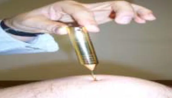 Fig.  2.  Rainbow  Power  Treatment