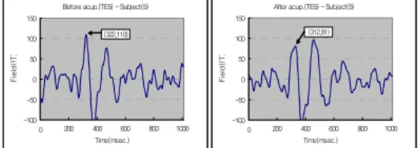 Fig. 8. The  changes  of  MEG  obtained  by  SQUID  induced  by  Acupuncture  on  GB43.