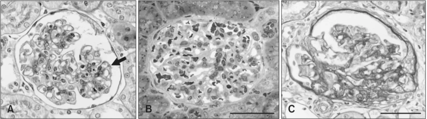 Fig. 1. Representative features of renal glomeruli in male Osborne-Mendel (OM) rats observed with light microscopy