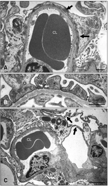 Fig. 3. (A) Denuded GBM (arrows) resulting from FP  detachment in a 24-week old male OM rat